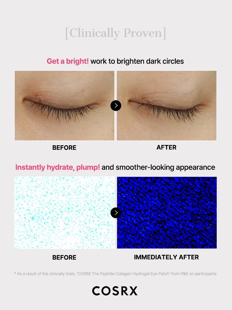 THE PEPTIDE COLLAGEN HYDROGEL EYE PATCH
